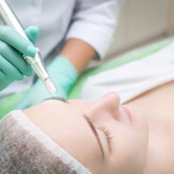 Diamant-Mikrodermabrasion Plus (Peeling)
